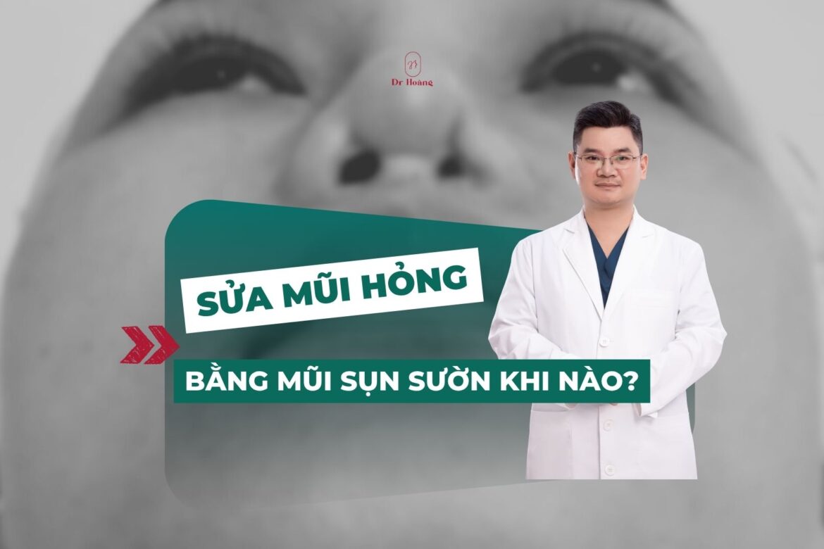 Sửa mũi hỏng bằng sụn sườn