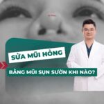 Sửa mũi hỏng bằng sụn sườn