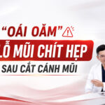 Lỗ mũi chít hẹp sau cắt cánh
