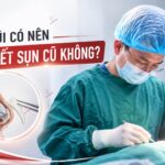 sửa mũi có nên tháo hết sụn