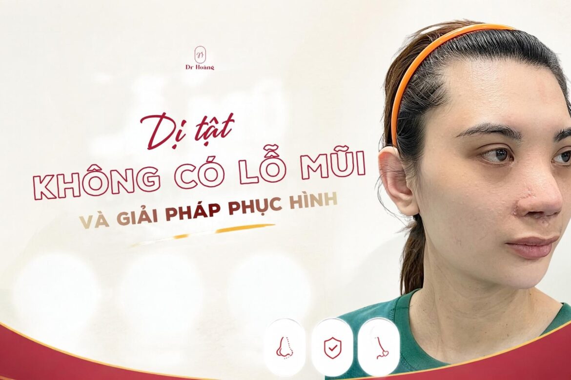 Dị tật không có lỗ mũi