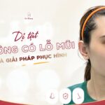 Dị tật không có lỗ mũi