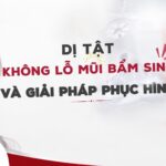 Không có lỗ mũi