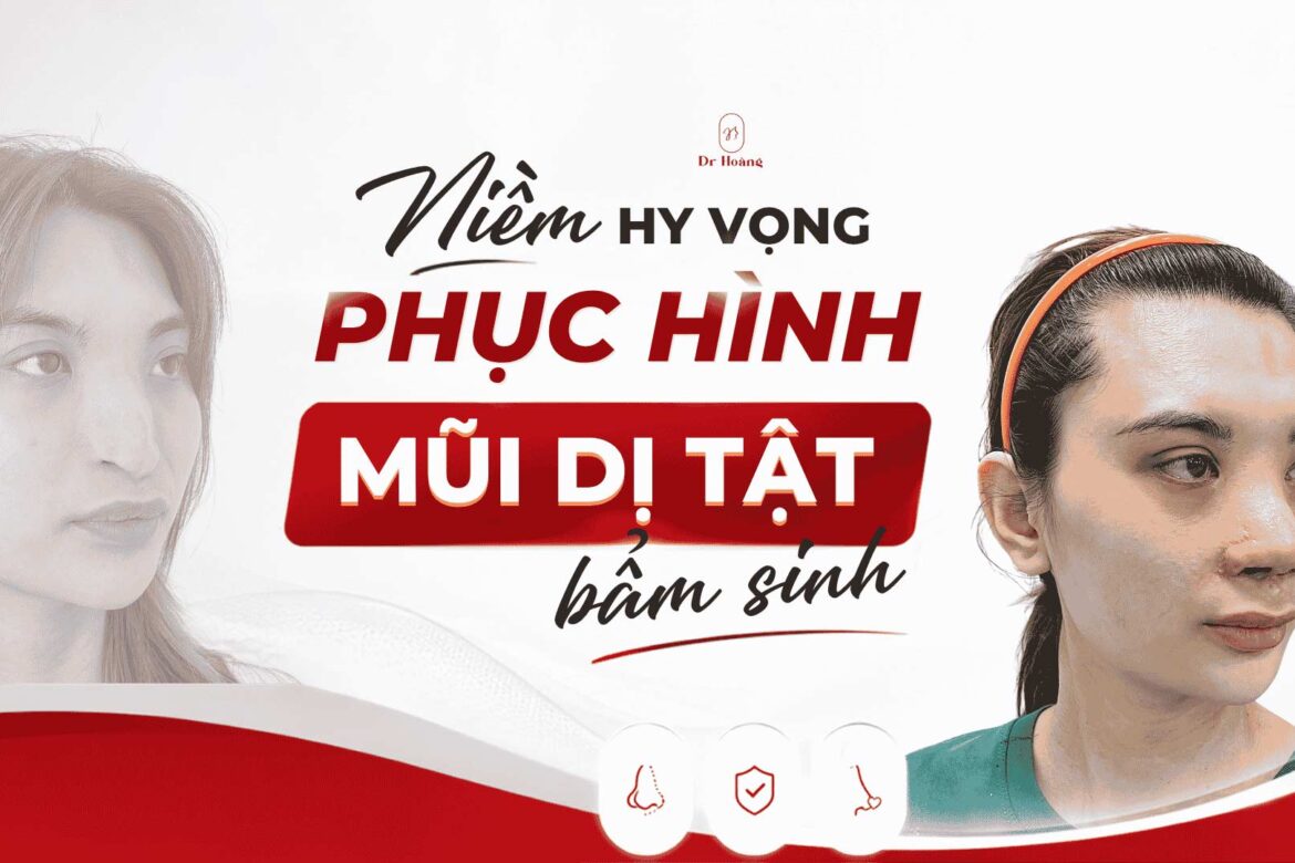 mũi dị tật bẩm sinh