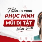 mũi dị tật bẩm sinh